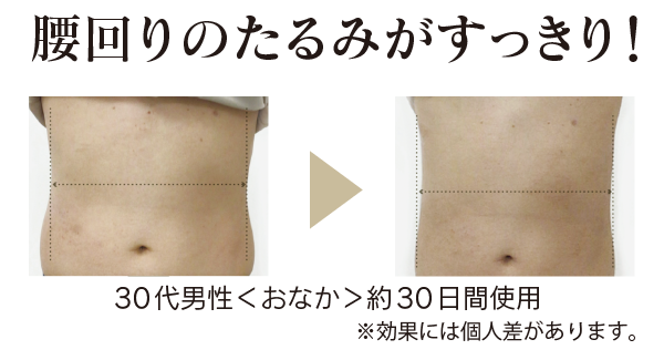 スリマスールフィット