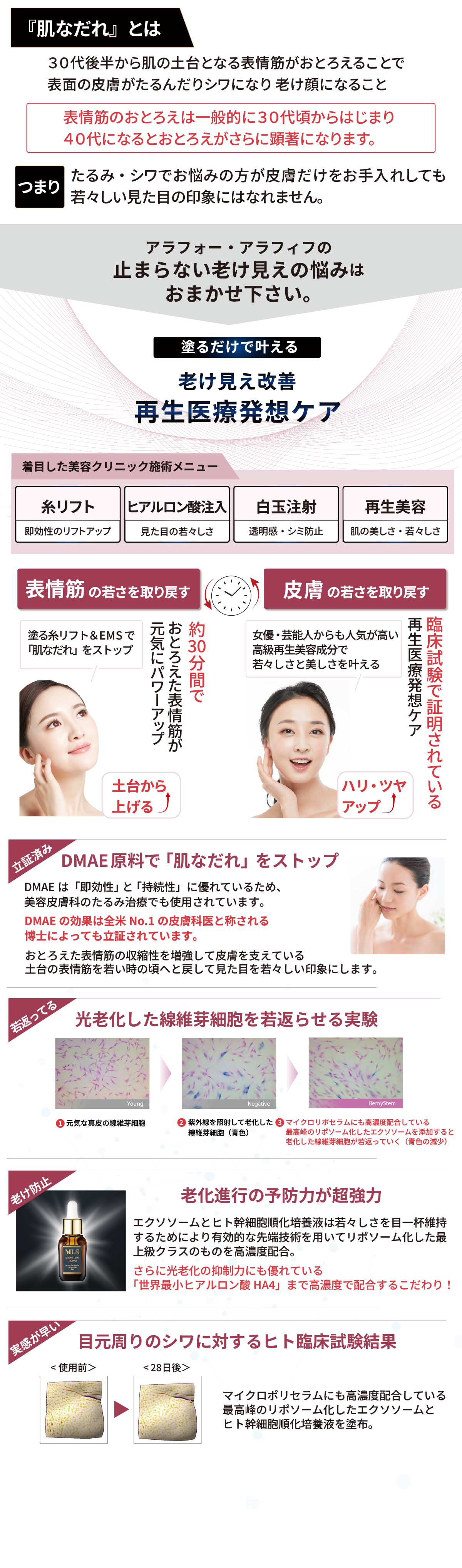 東京・吉祥寺・マリスローレン・マイクロリポセラム