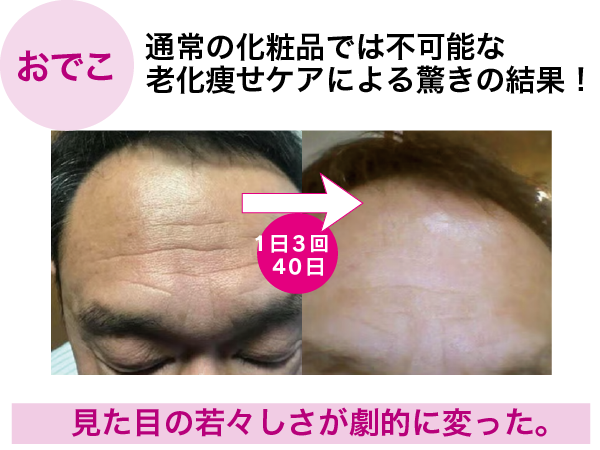東京・吉祥寺・マリスローレン・裏技美容液で若さを取り戻す・セインムー・ボーテロンド